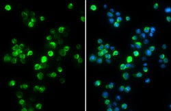 Invitrogen IBA1 Polyclonal Antibody 100 &mu;L; Unconjugated:Antibodies,