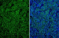 Invitrogen CD19 Polyclonal Antibody 100 &mu;L; Unconjugated:Antibodies,