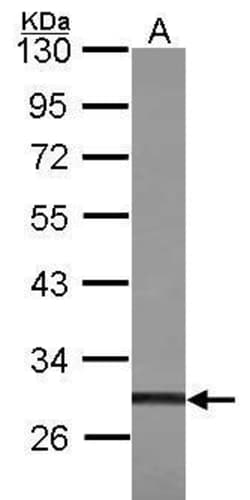 Invitrogen ZFP36L1 Polyclonal Antibody 100 &mu;L; Unconjugated:Antibodies,