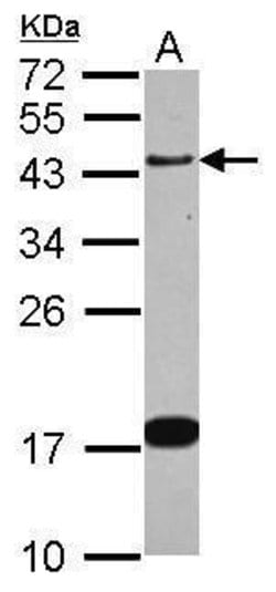 Invitrogen GAP43 Polyclonal Antibody 100 &mu;L; Unconjugated:Antibodies,