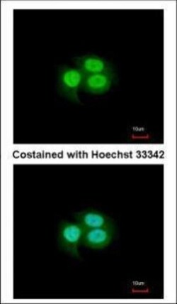 Invitrogen MSI1 Polyclonal Antibody 100 &mu;L | Buy Online | Invitrogen&trade; | Fisher Scientific