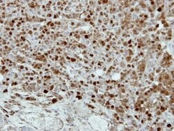 Invitrogen CRABP2 Polyclonal Antibody 100 &mu;L; Unconjugated:Antibodies,