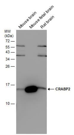 Invitrogen CRABP2 Polyclonal Antibody 100 &mu;L; Unconjugated:Antibodies,