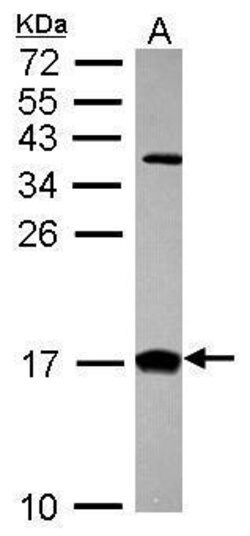 Invitrogen CRABP2 Polyclonal Antibody 100 &mu;L; Unconjugated:Antibodies,