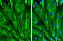 Invitrogen Galectin 1 Polyclonal Antibody 100 &mu;L; Unconjugated:Antibodies,