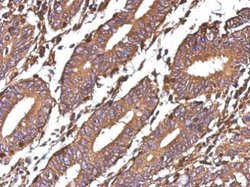 Invitrogen Galectin 1 Polyclonal Antibody 100 &mu;L; Unconjugated:Antibodies,