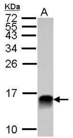 Invitrogen Galectin 1 Polyclonal Antibody 100 &mu;L; Unconjugated:Antibodies,