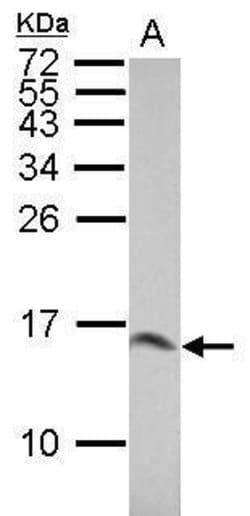 Invitrogen Galectin 1 Polyclonal Antibody 100 &mu;L; Unconjugated:Antibodies,