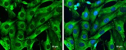 Invitrogen Galectin 1 Polyclonal Antibody 100 &mu;L; Unconjugated:Antibodies,