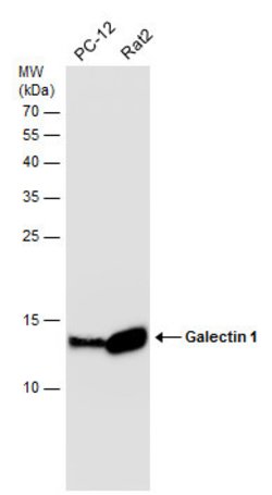 Invitrogen Galectin 1 Polyclonal Antibody 100 &mu;L; Unconjugated:Antibodies,