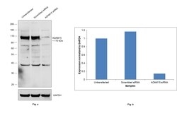 Invitrogen ADAM15 Polyclonal Antibody 100 &mu;L | Buy Online | Invitrogen&trade; | Fisher Scientific