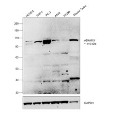 Invitrogen ADAM15 Polyclonal Antibody 100 &mu;L | Buy Online | Invitrogen&trade; | Fisher Scientific