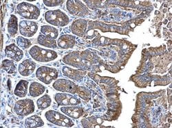 Invitrogen alpha Adducin Polyclonal Antibody 100 &mu;L; Unconjugated:Antibodies,