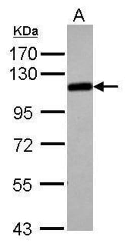 Invitrogen alpha Adducin Polyclonal Antibody 100 &mu;L; Unconjugated:Antibodies,