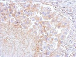 Invitrogen Annexin A6 Polyclonal Antibody 100 &mu;L; Unconjugated:Antibodies,