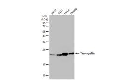 Invitrogen TAGLN Polyclonal Antibody 100 &mu;L; Unconjugated:Antibodies,