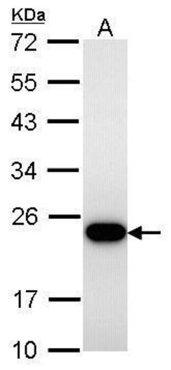 Invitrogen TAGLN Polyclonal Antibody 100 &mu;L; Unconjugated:Antibodies,