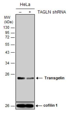 Invitrogen TAGLN Polyclonal Antibody 100 &mu;L; Unconjugated:Antibodies,