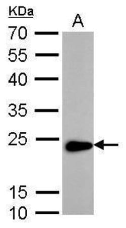 Invitrogen TAGLN Polyclonal Antibody 100 &mu;L; Unconjugated:Antibodies,
