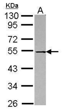 Invitrogen DOK1 Polyclonal Antibody 100 &mu;L; Unconjugated:Antibodies,
