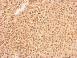 Invitrogen RPL11 Polyclonal Antibody 100 μL; Unconjugated:Antibodies,