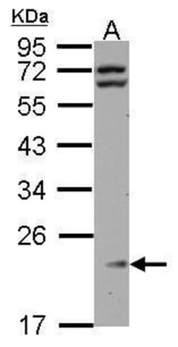 Invitrogen RPL11 Polyclonal Antibody 100 μL; Unconjugated:Antibodies,