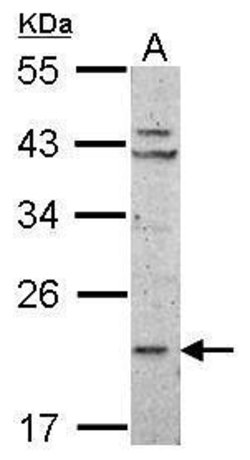 Invitrogen RPL11 Polyclonal Antibody 100 μL; Unconjugated:Antibodies,