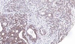 Invitrogen UBE2M Polyclonal Antibody 100 &mu;L | Buy Online | Invitrogen&trade; | Fisher Scientific