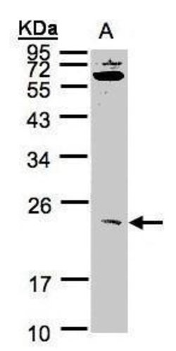 Invitrogen UBE2M Polyclonal Antibody 100 &mu;L | Buy Online | Invitrogen&trade; | Fisher Scientific
