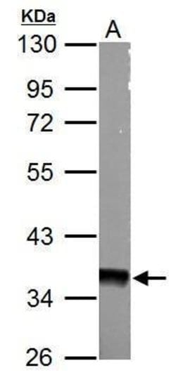 Invitrogen AMPK gamma-1 Polyclonal Antibody 100 &mu;L; Unconjugated:Antibodies,