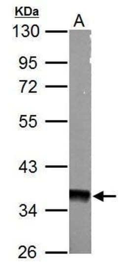 AMPK gamma-1 Polyclonal Antibody, Invitrogen&trade; 100 &mu;L; Unconjugated 