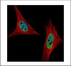 Invitrogen SNRPA Polyclonal Antibody 100 &mu;L | Buy Online | Invitrogen&trade; | Fisher Scientific