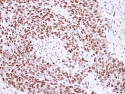Invitrogen SNRPA Polyclonal Antibody 100 &mu;L | Buy Online | Invitrogen&trade; | Fisher Scientific