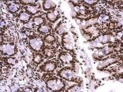 Invitrogen SNRPA Polyclonal Antibody 100 &mu;L | Buy Online | Invitrogen&trade; | Fisher Scientific