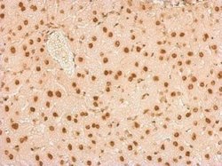 Invitrogen SNRPA Polyclonal Antibody 100 &mu;L | Buy Online | Invitrogen&trade; | Fisher Scientific