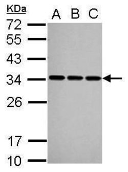 Invitrogen SNRPA Polyclonal Antibody 100 &mu;L | Buy Online | Invitrogen&trade; | Fisher Scientific