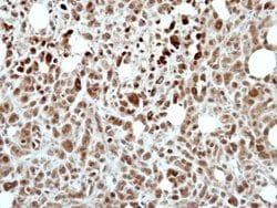 Invitrogen RING1 Polyclonal Antibody 100 &mu;L; Unconjugated:Antibodies,