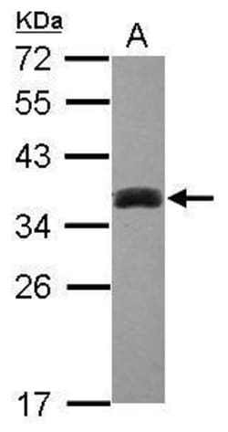 Invitrogen SULT1A3 Polyclonal Antibody 100 &mu;L; Unconjugated:Antibodies,