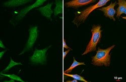 Invitrogen GRK2 Polyclonal Antibody 100 &mu;L; Unconjugated:Antibodies,