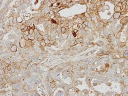 Invitrogen GRK2 Polyclonal Antibody 100 &mu;L; Unconjugated:Antibodies,