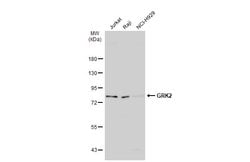 Invitrogen GRK2 Polyclonal Antibody 100 &mu;L; Unconjugated:Antibodies,