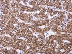 Invitrogen SDHA Polyclonal Antibody 100 &mu;L; Unconjugated:Antibodies,