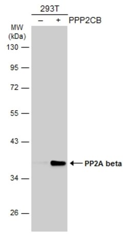Invitrogen PP2A beta Polyclonal Antibody 100 &mu;L; Unconjugated:Antibodies,
