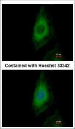 Invitrogen PP2A beta Polyclonal Antibody 100 &mu;L; Unconjugated:Antibodies,