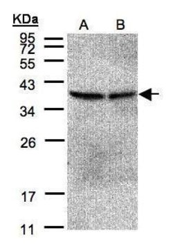 Invitrogen PP2A beta Polyclonal Antibody 100 &mu;L; Unconjugated:Antibodies,