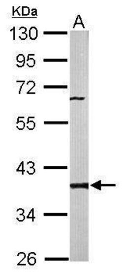 Invitrogen PP2A beta Polyclonal Antibody 100 &mu;L; Unconjugated:Antibodies,