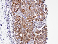 Invitrogen Septin 2 Polyclonal Antibody 100 &mu;L; Unconjugated:Antibodies,