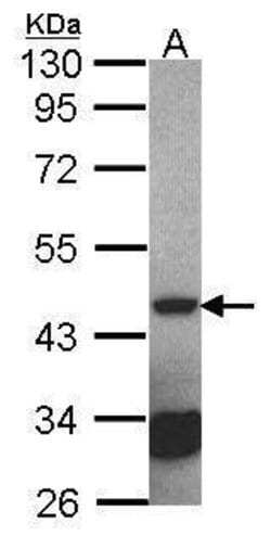 Invitrogen Septin 2 Polyclonal Antibody 100 &mu;L; Unconjugated:Antibodies,