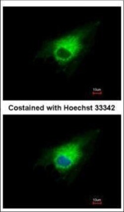 Invitrogen PGD Polyclonal Antibody 100 &mu;L | Buy Online | Invitrogen&trade; | Fisher Scientific