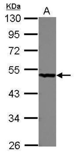 Invitrogen PGD Polyclonal Antibody 100 &mu;L | Buy Online | Invitrogen&trade; | Fisher Scientific
